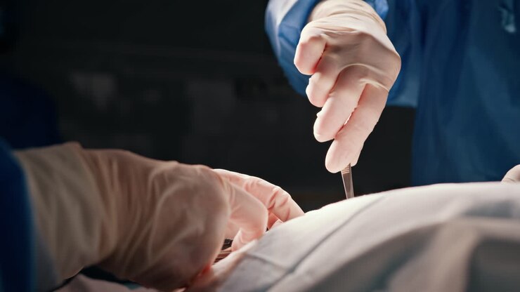 procedura chirurgica