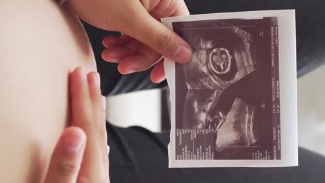 Mujer-Sosteniendo-Una-Imagen-De-Ultrasonido-Y-Frotando-Su-Vientre,-Vista-De-Cerca-Vertical