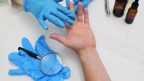 a medical professional examining a patient's hand with blue gloves