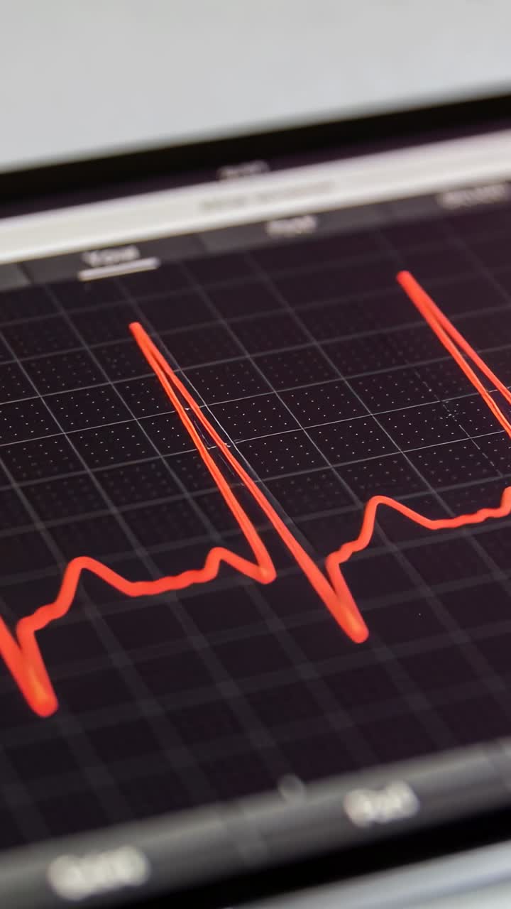 Vertical video: Receiving live signal, touchscreen tablet displaying red ECG trace on desk