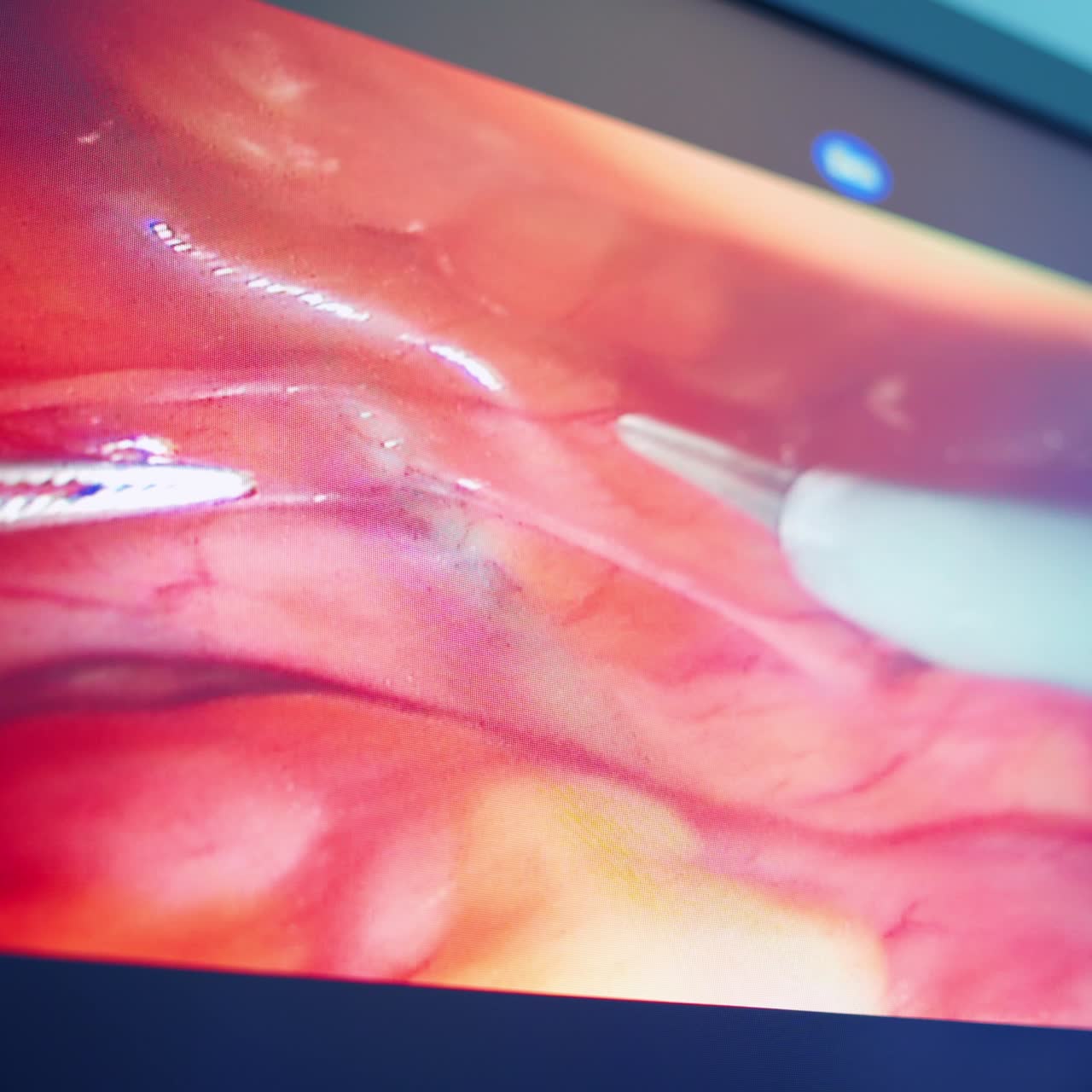 Robotic surgical system da Vinci. Modern equipment in operating room.