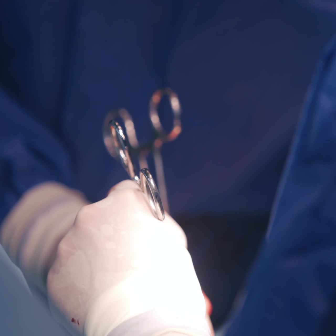 Surgeons hands in gloves with medical instruments. Group of doctors operate the patient. Hands in blood with medical scissors during surgery. Close-up.