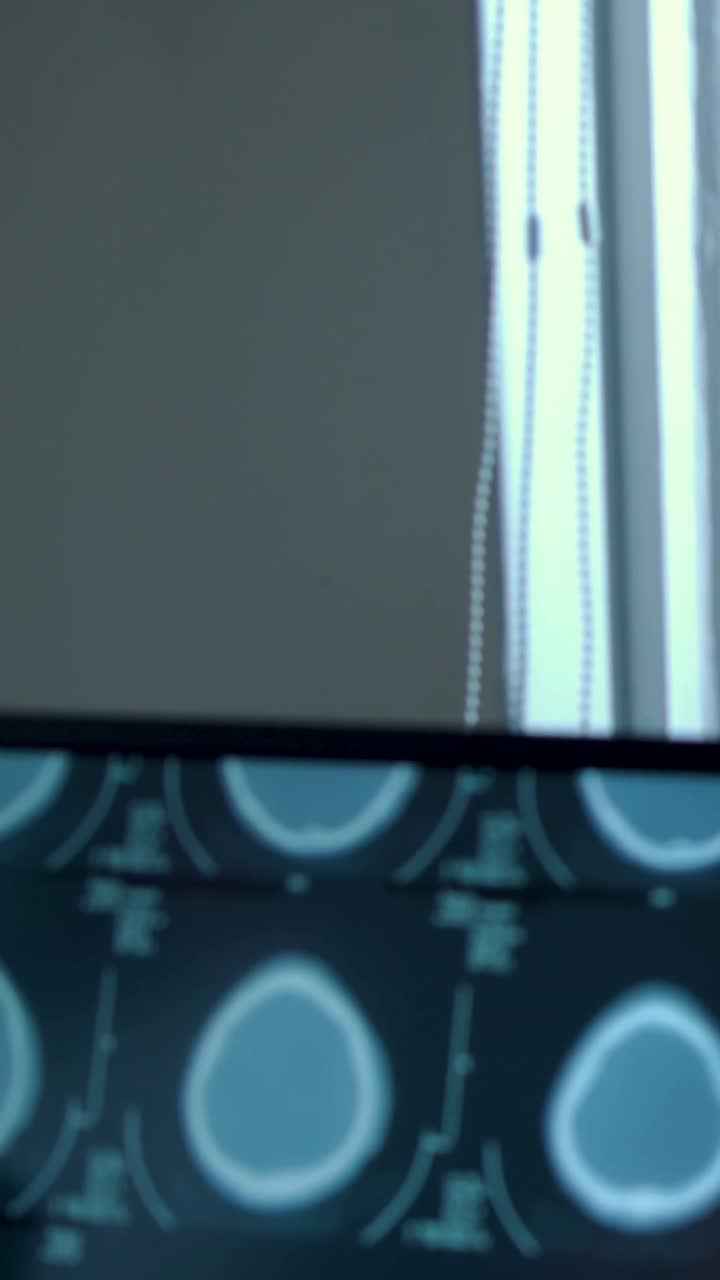 Video verticale: Una mano, con manica tecnica, entra e indica, poi tocca un monitor in una clinica che visualizza scansioni cerebrali.