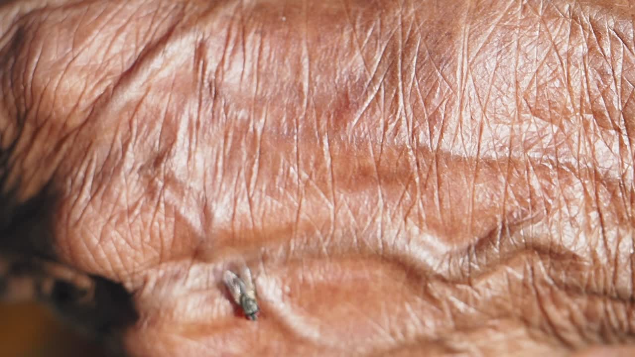 Close-up of aged human skin with wrinkles and a small insect