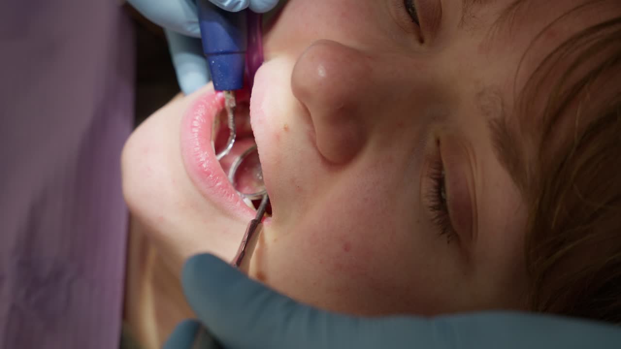 Close-up of Child Receiving Dental Cleaning in Dentist's Office