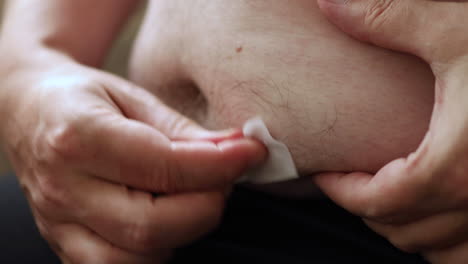 Close-up-of-cleaning-the-abdomen-with-a-wet-hygiene-wipe-in-preparation-to-self-apply-medicine-through-a-medical-needle-pen-injecting-the-substance-in-a-fatty-area-of-the-belly