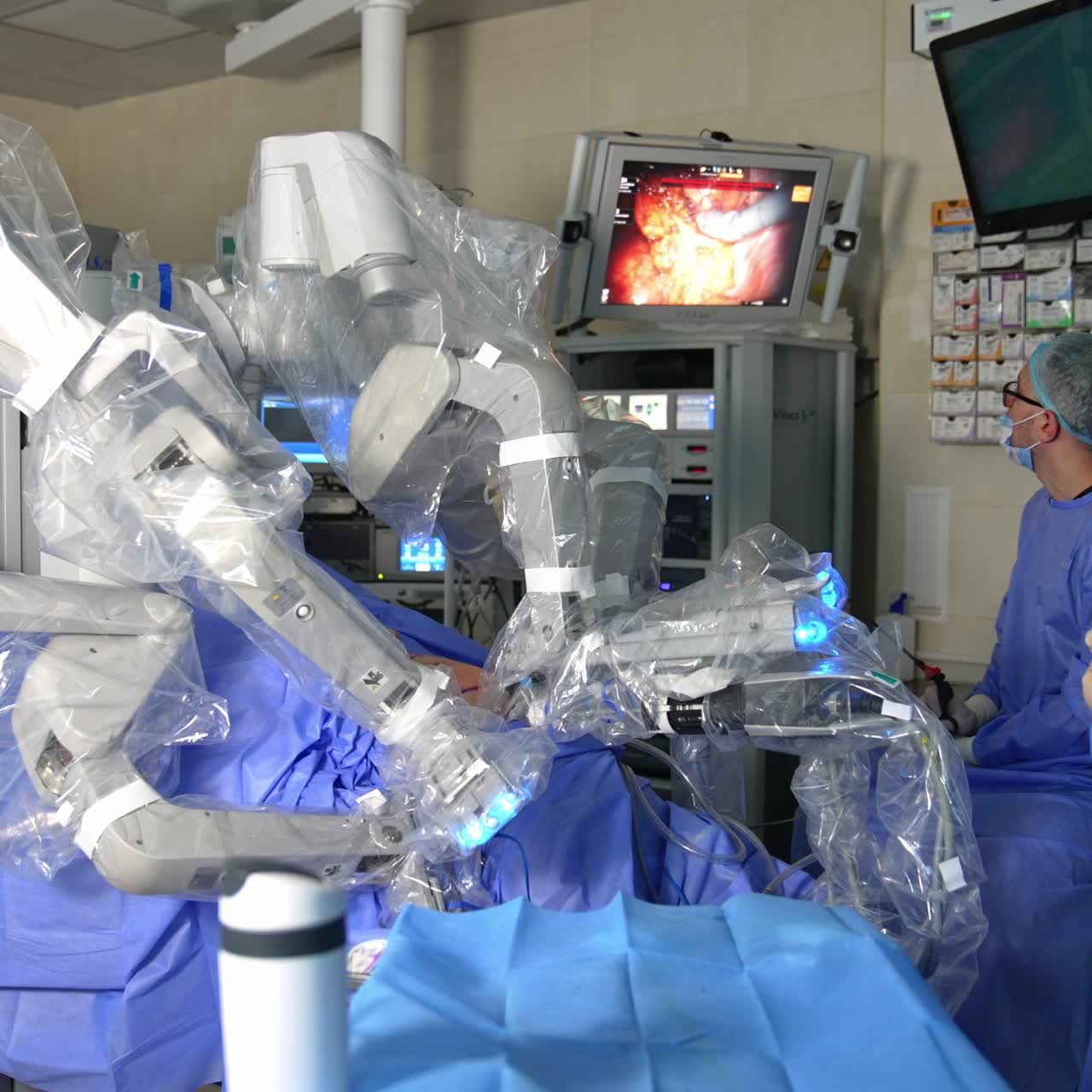 Doctors watching the work of Da Vinci robot on the screen in surgery room. Innovative equipment performing laparoscopic surgery in modern clinics