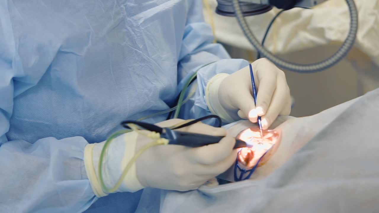 procedimiento de cirugía ocular