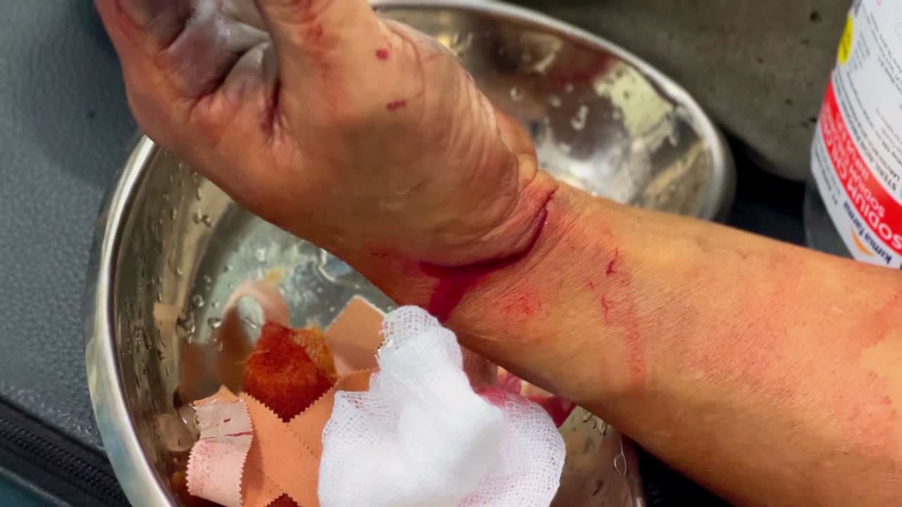 The wound was scratched on the wrist and bleeding