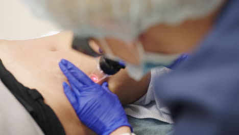 procedimiento cosmético en el abdomen