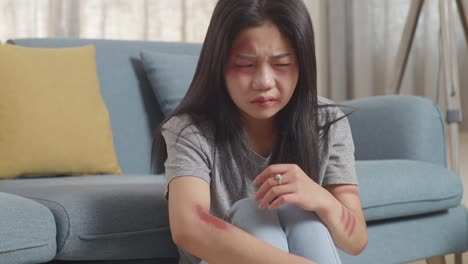 close up of young asian woman victim of violence sitting on the floor and touching bruise on her body being hurt from physically abused at home