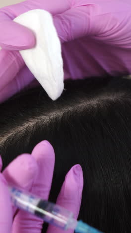 needle mesotherapy. cosmetic been injected in woman's head. thrust to strengthen hair and their growth vertical video