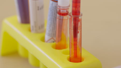 red specimen in a sample tube