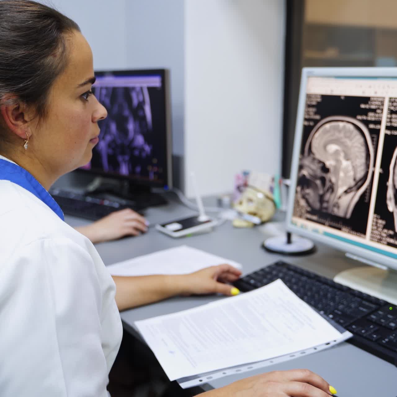 Brunet woman lab technician looking at the brain scan at computer screen. Process of diagnose in clinics