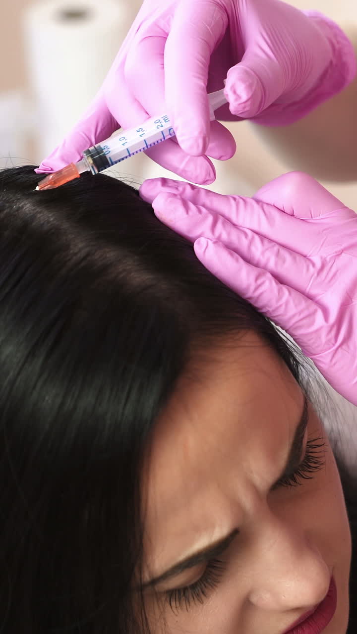 Injections for healthy hair growth. Mesotherapy. Aesthetic cosmetology Vertical video