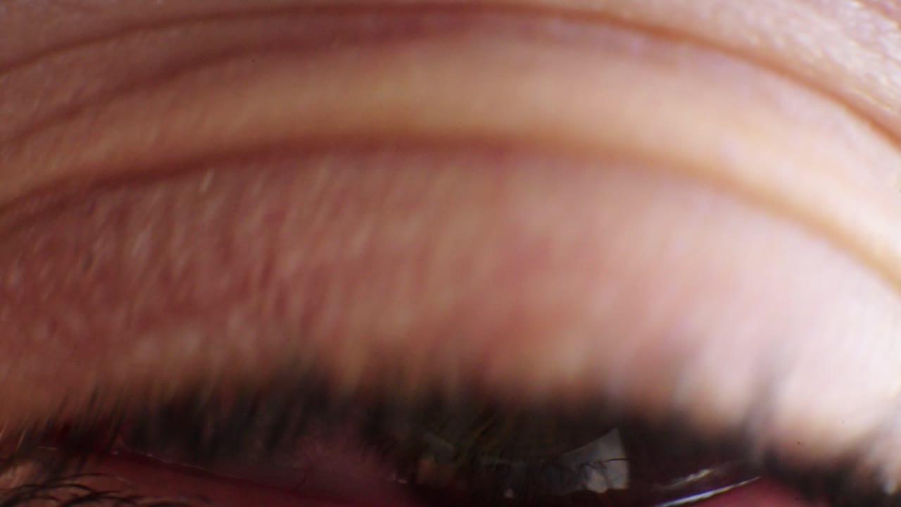 Eye Wide Open Looking Scared Showing Fear Emotion. Close-up, Macro