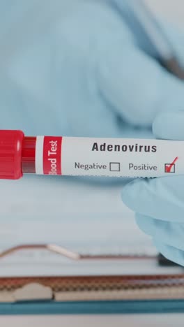 doctor shows encouraging blood test result for adenovirus infection detection