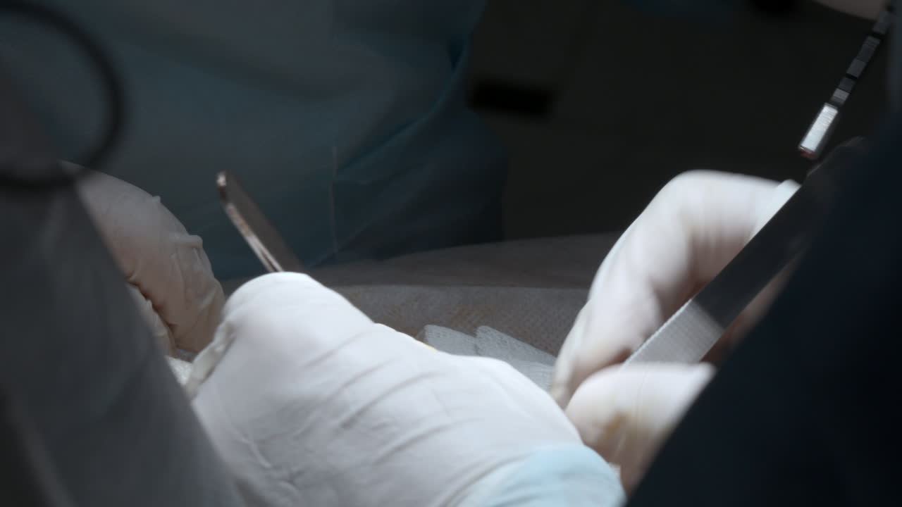 procedimiento quirúrgico