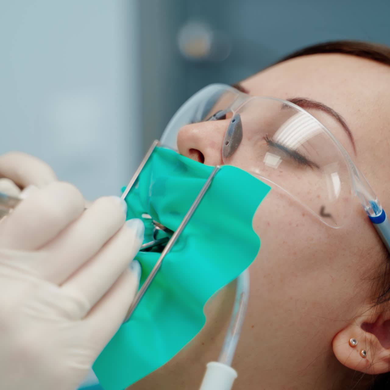 Giovane paziente nello studio dentistico. Primo piano di una procedura odontoiatrica sui denti