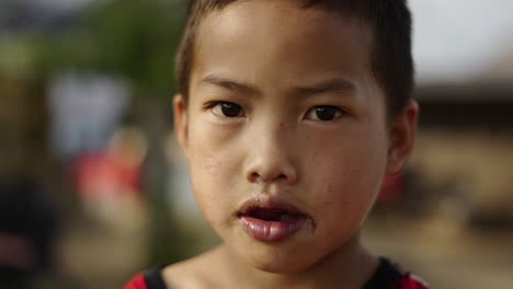 close-up portrait of a young boy with a cut lip