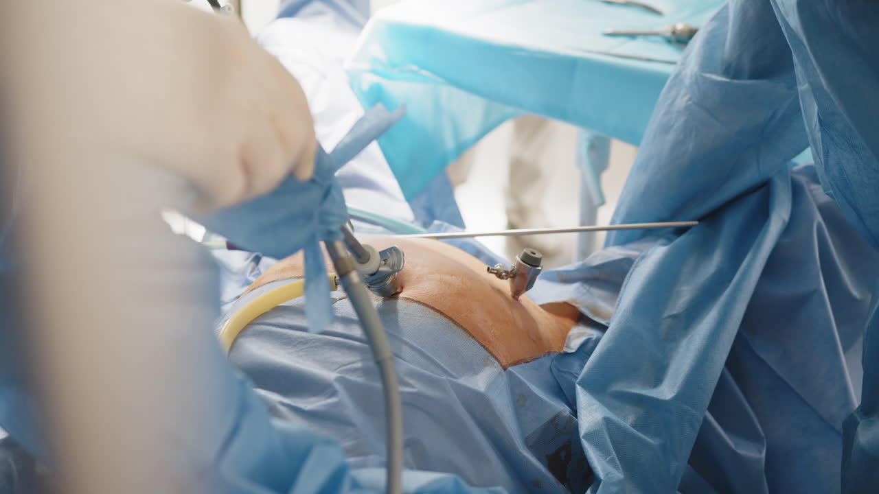 cirugía abdominal laparoscópica