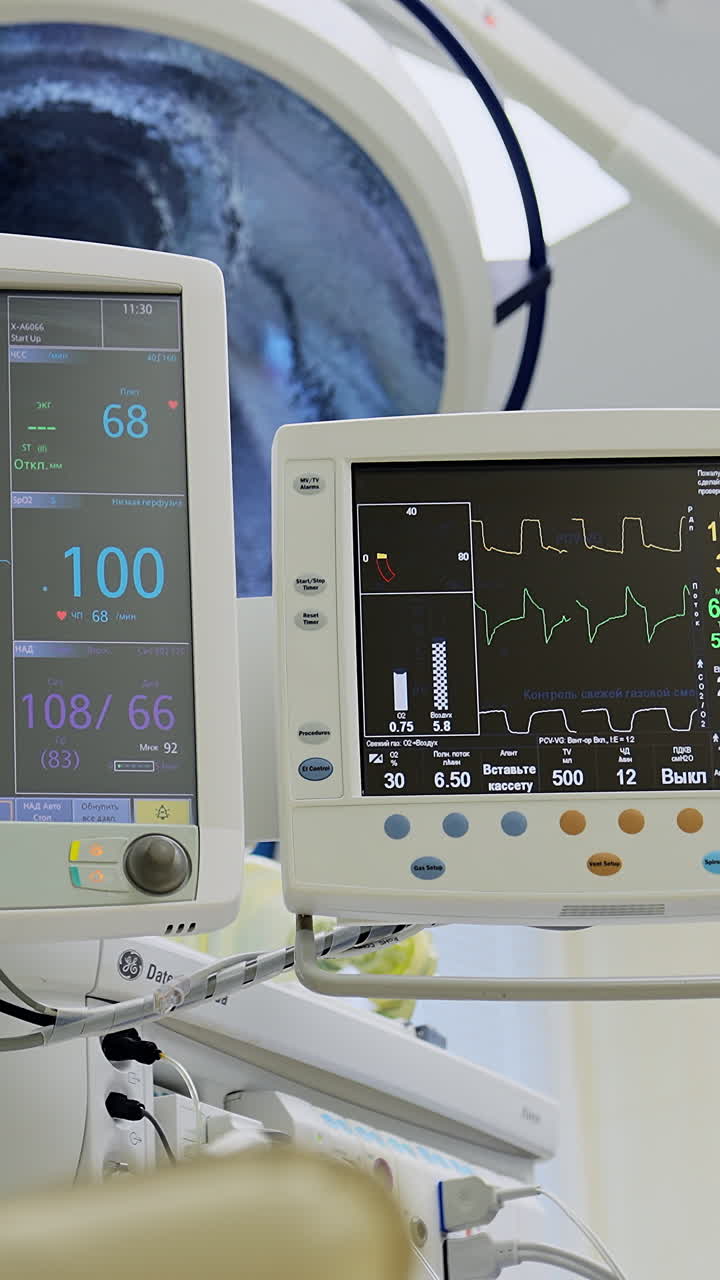 Pair of monitors displaying the condition of a patient at operation. Medical respiratory and life support systems in a hospital clinic. Vertical video