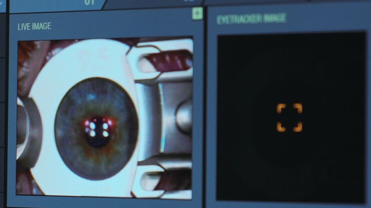 Ophthalmic surgery. View on the screen of medical monitor in operating room. Lasik