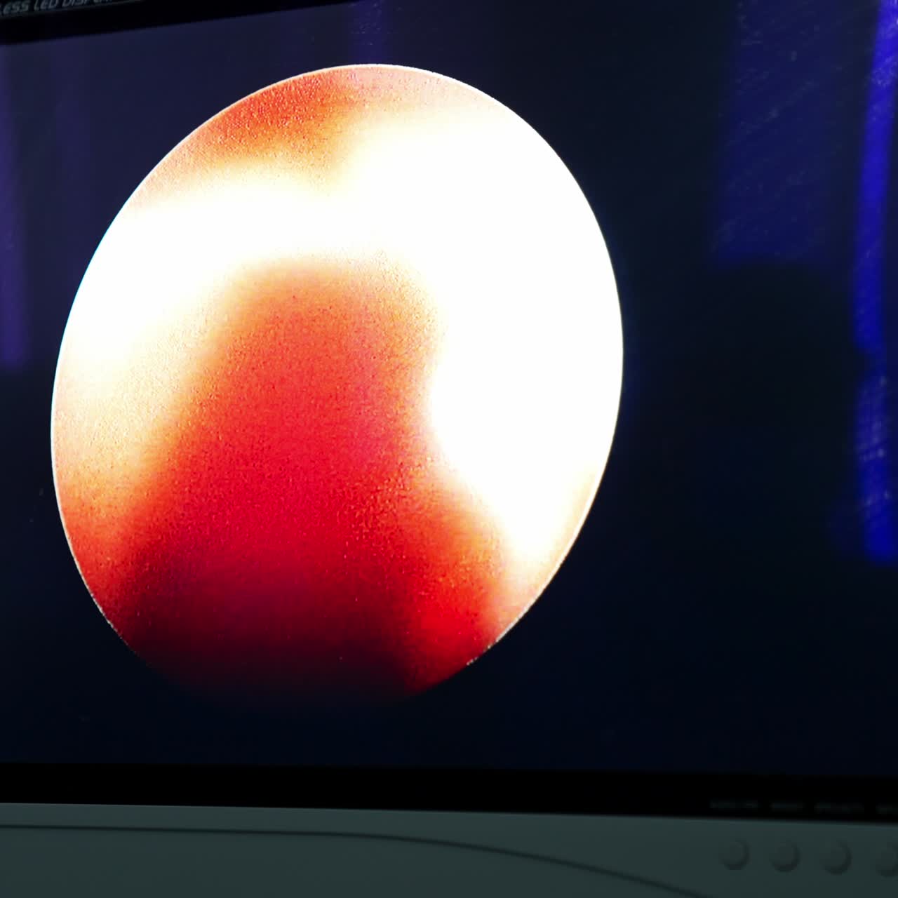 Medical vital signs monitor instrument in a hospital on anesthesia surgery monitor