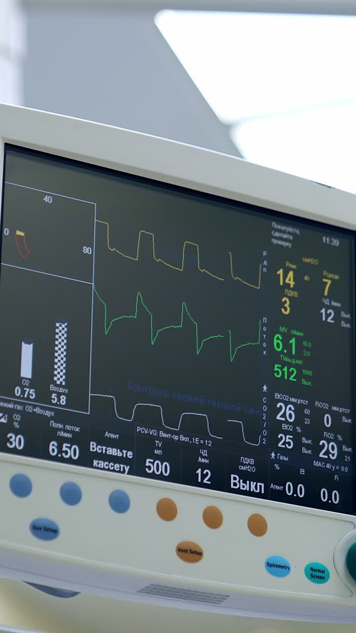 Observing the screens of artificial lung ventilation apparatus working in the surgical room. Monitors with patient's life parameters from low angle view. Vertical video