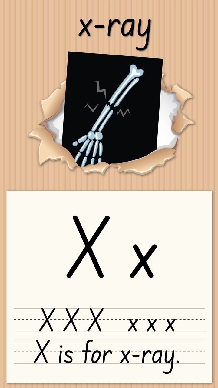 Animazione educativa verticale che insegna la lettera X utilizzando un'immagine a raggi X e righe per la pratica della calligrafia.