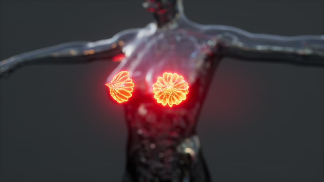 염증의 초점인 암을 가진 여성 유방