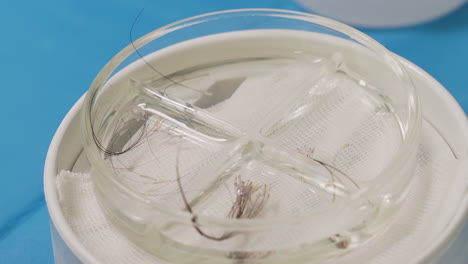 vaso quirúrgico con unidades de pelo largo en líquido de preservación para trasplante de cabello