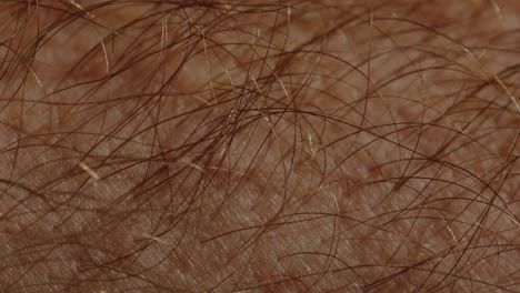 Makroaufnahme-Von-Haaren-Auf-Kaukasischer-Haut-Mit-Extremen-Details,-Einschließlich-Haarwurzelkanal