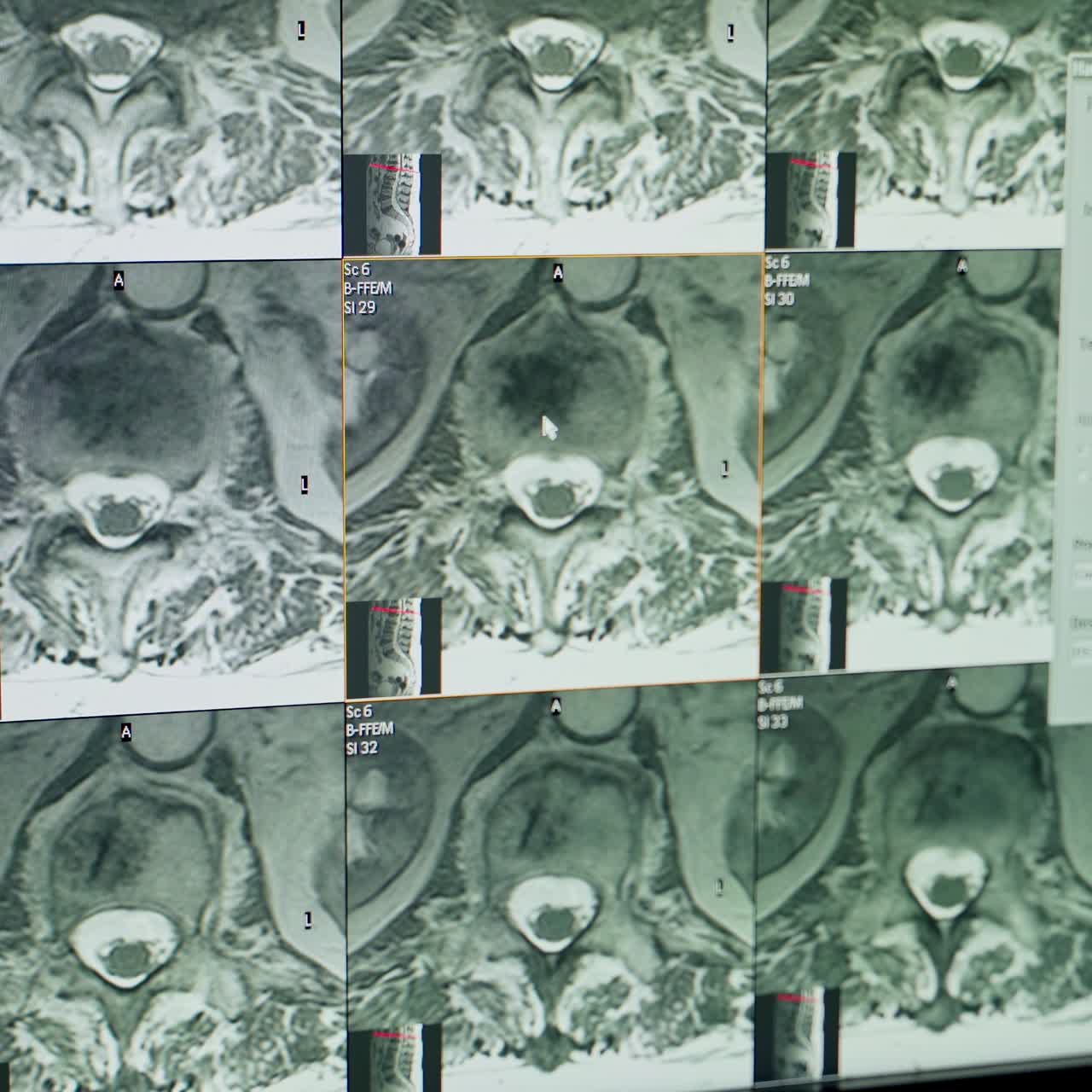 X-ray scan of the patient