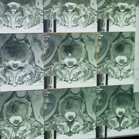x-ray scan of the patient