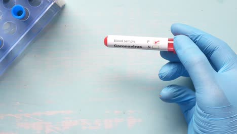 prueba de muestra de sangre de coronavirus