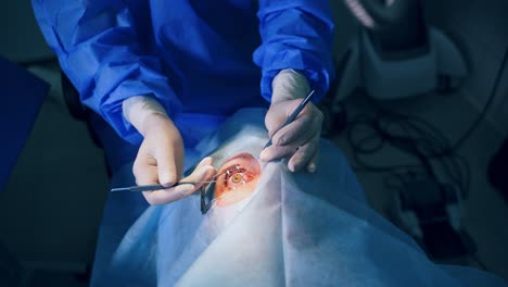 ophthalmology surgery for eyes. patient in the operating room during ophthalmic surgery