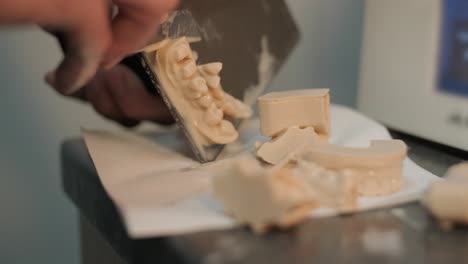 coronas y puentes dentales impresos en 3d en posprocesamiento