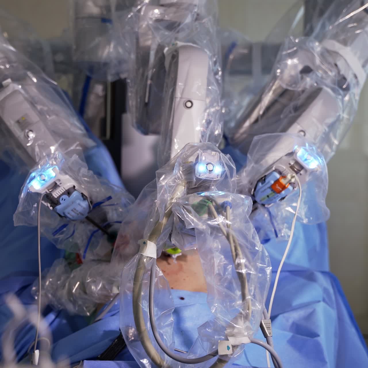 Da Vinci robot performing surgical operation. High-precise technological equipment carrying out the surgery