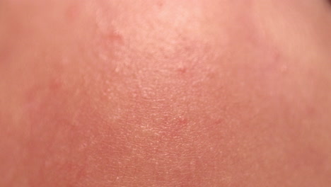 close-up image of a baby’s skin revealing the delicate texture, visible blood vessels, and minor rashes. an intimate look at infant skin health and development
