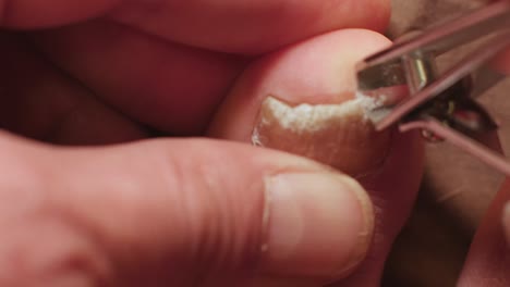 clipping crumbly chunks of fungus-infected toenail