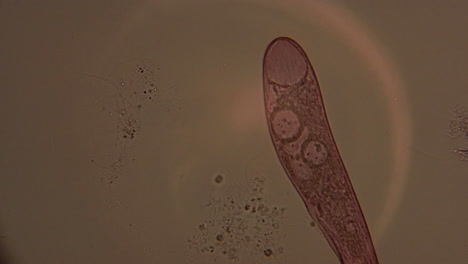 A-microscopic-view-of-the-single-celled-organism,-Blepharisma