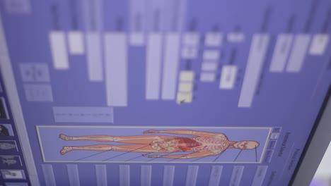 monitor displaying information about a patient as he is registered in a clinic's database to be scanned with a machine known as spect, which scans patients with tumors in different parts of the body