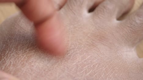 close-up of dry and cracked foot skin