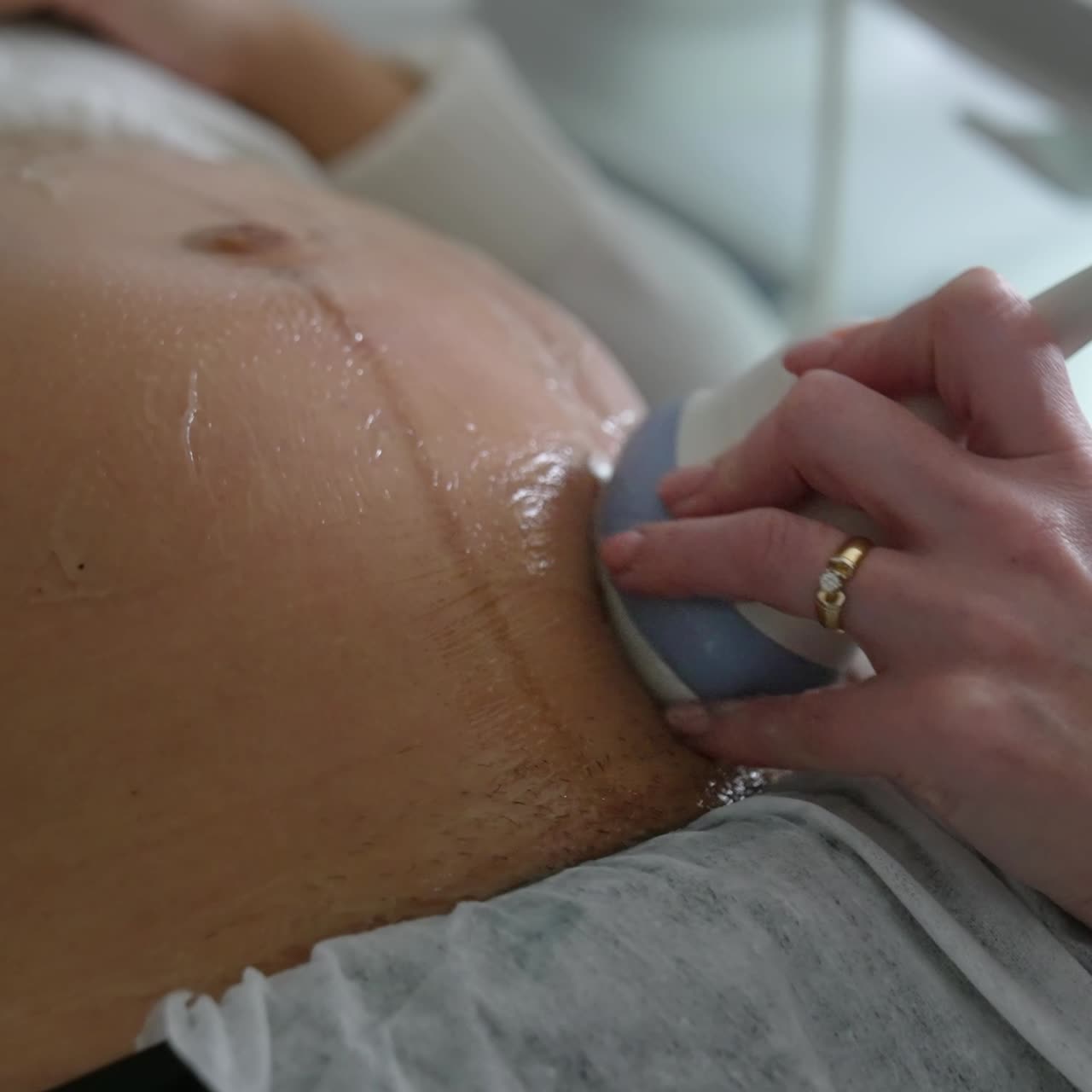 En gravid kvindes mave smurt ind i speciel gel. En læge bevæger ultralydssensoren hen over patientens mave. Tæt på