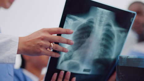 reunión, discusión y médicos analizando las radiografías