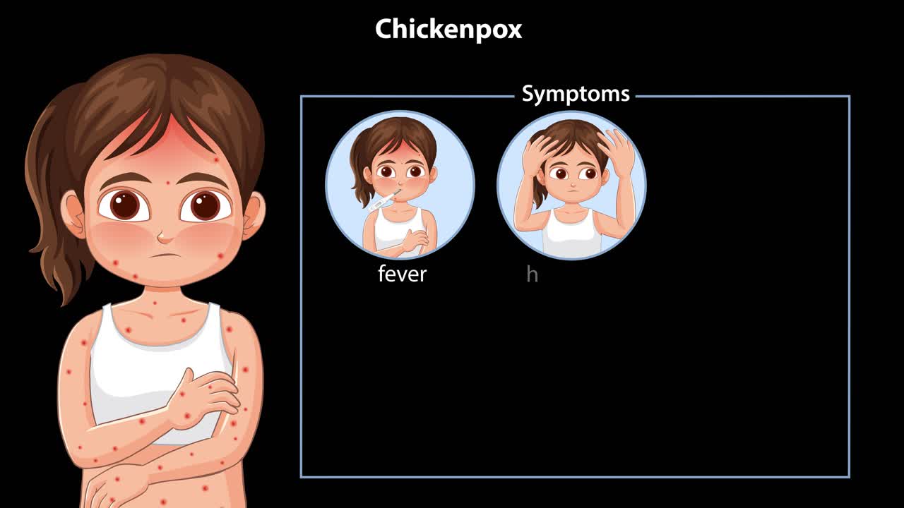 Animated sequence highlights chickenpox symptoms in a girl, with labeled icons and smooth transitions