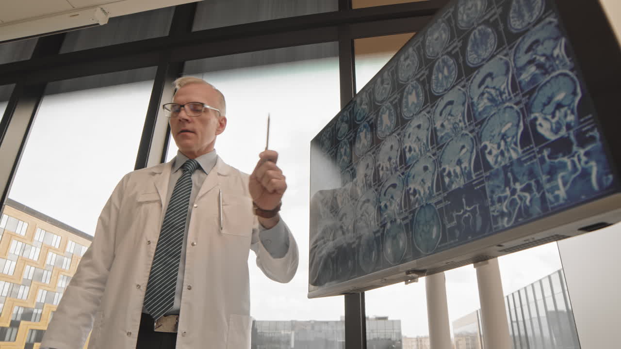 Doctor explaining brain scan results