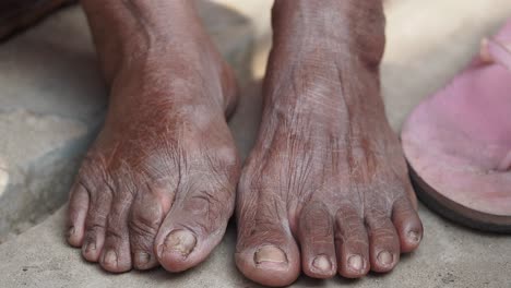 close-up of aged feet