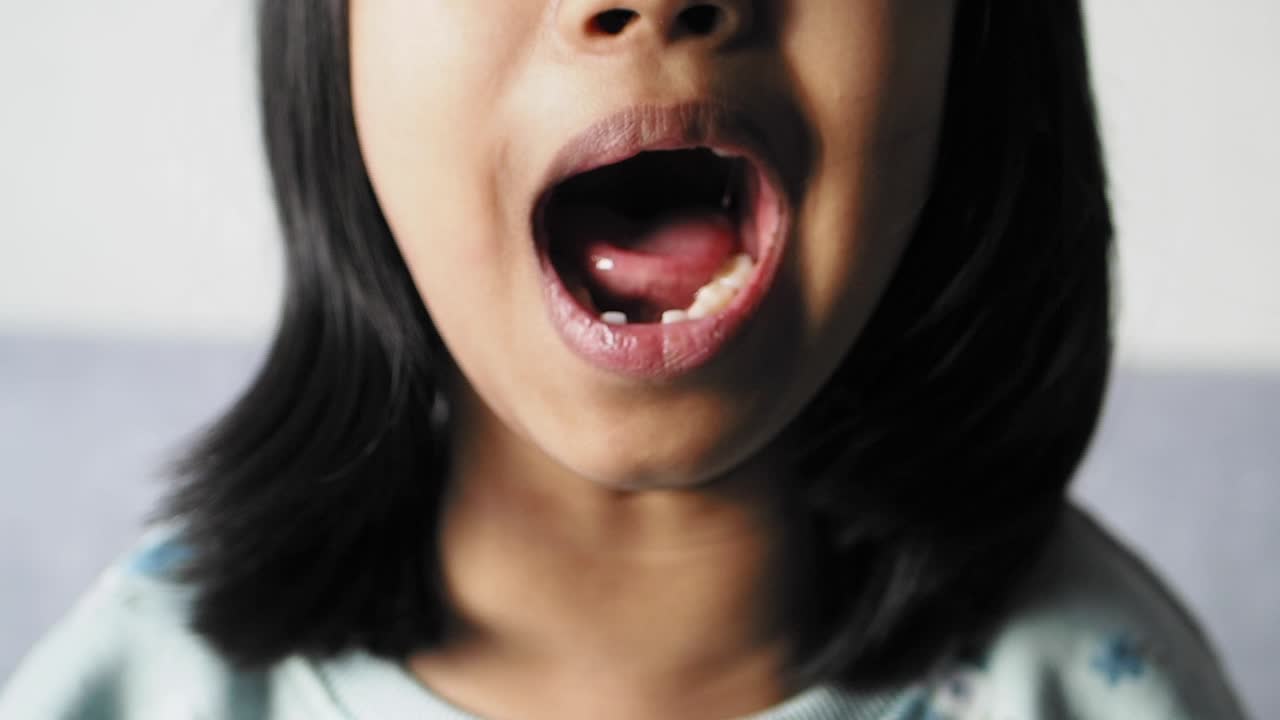 입이 열린 아이